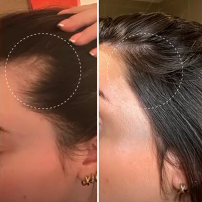 Corretor de cabelo